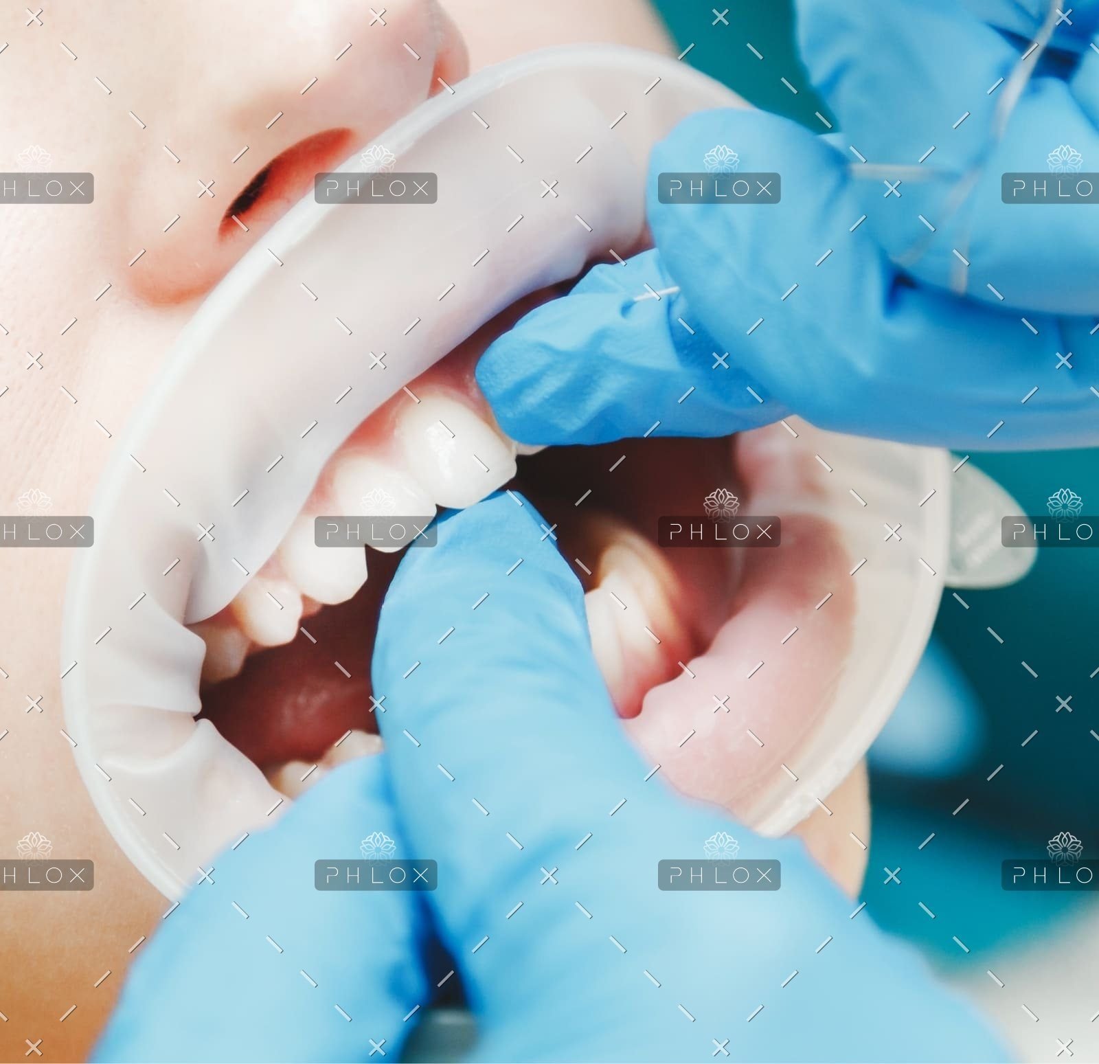 demo-attachment-718-Mask-G2roup-56-1